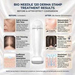 Derma Stamp Bio Needle – Aparat Microneedling Reglabil (120 Ace) - imagine 3